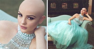 El cáncer no detiene a esta modelo; ella demuestra que es hermosa con una sesión de fotos