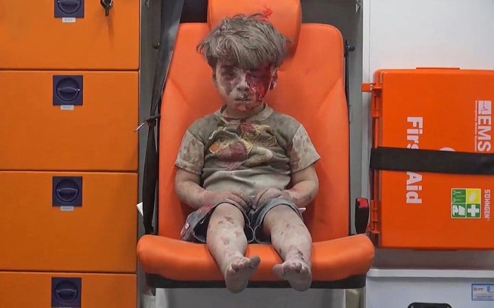 niño sirio sobreviviente ataque aereo
