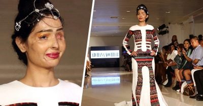 Esta mujer fue quemada con ácido y perdió un ojo, hoy rompe los estereotipos y desfila en Nueva York