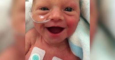 La foto de este bebé prematuro sonriendo a sus padres se convierte en una inspiración para el mundo
