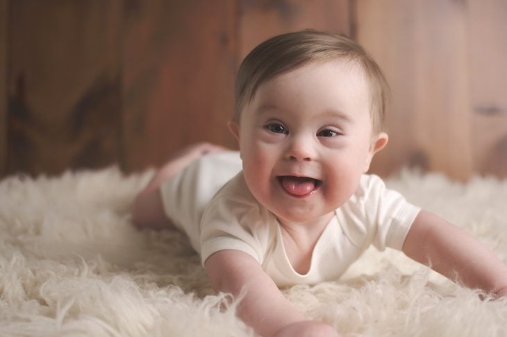 bebé con síndrome de Down