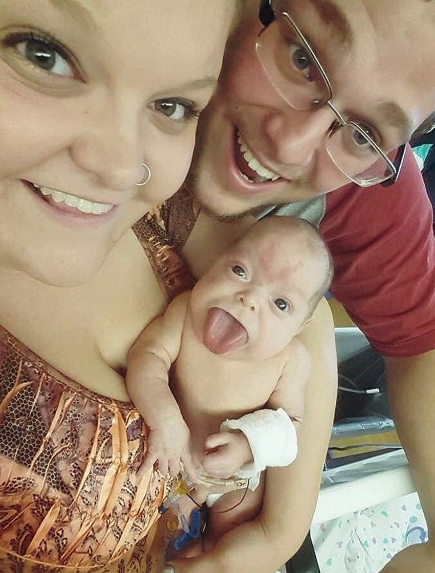 Nacio Con La Lengua Enorme Y Sonrie Despues De Una Cirugia Nacio Con La Lengua Enorme Y Sonrie Despues De Una Cirugia