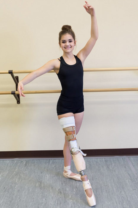 Bailarina de ballet con una pierna amputada 