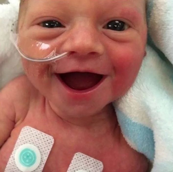 Bebé que nació de forma prematura sonriendo a la vida 