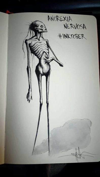 Anorexia