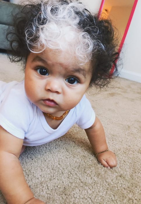 Niña pequeña con mechón blanco en el cabello