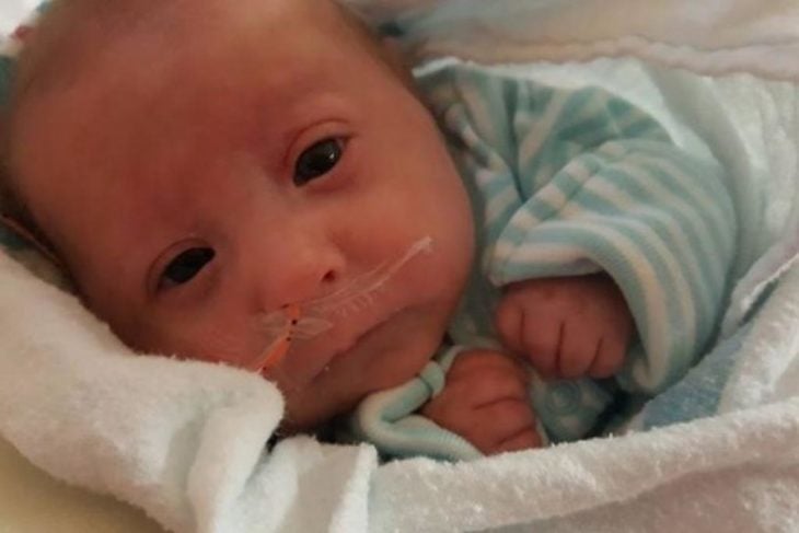 bebé que nació con enanismo respirando con la ayuda de oxigeno