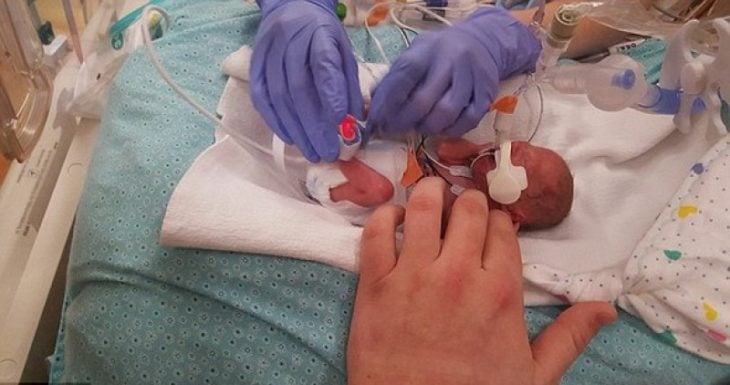Matthew bebé que nació con enanismo, siendo revisado por doctores 