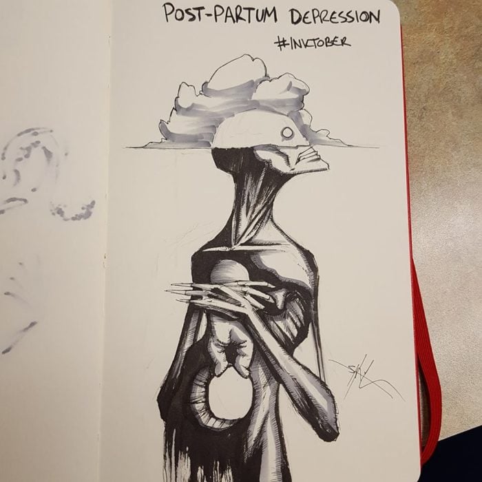Depresión postparto