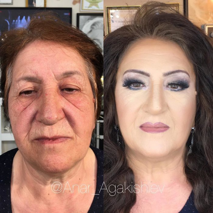 antes y después de una mujer a la que le regresaron su juventud