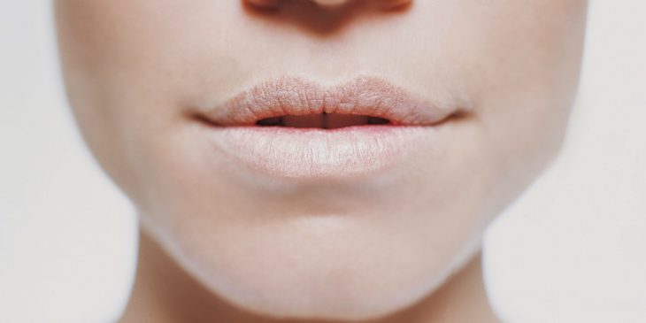 Labios agrietados