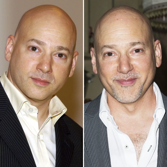 Evan Handler antes y después