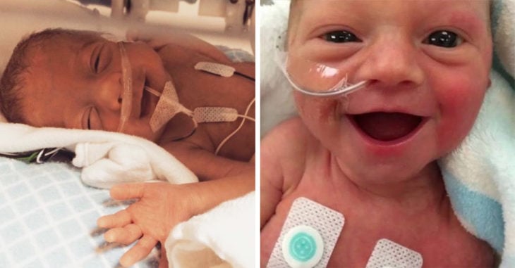 10 Fotografías de bebés prematuros que sonrien al vivir