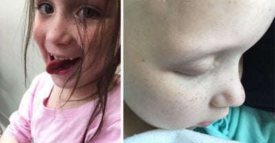 Este padre comparte la foto de la última pestaña de su hija con cáncer; te romperá el corazón