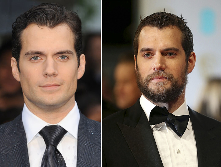 Henry Cavill con y sin barba. 