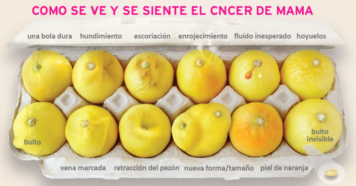 1 foto y 12 limones que pueden ayudarte a detectar el cáncer de mama