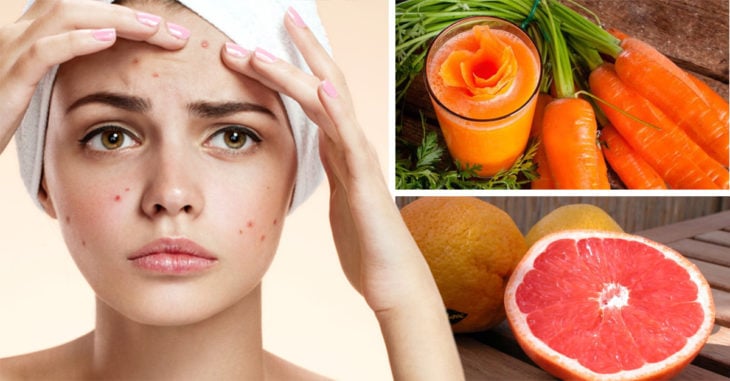 6 Alimentos que te ayudarán a eliminar el acné