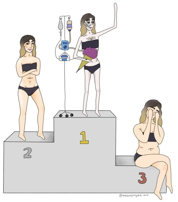 ilustraciones que demuestran lo que es la anorexia 