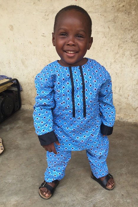 Niño de nigeria acusado de ser brujo recuperado completamente 