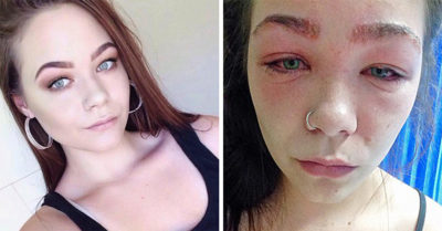 Ella solo quería unas cejas hermosas; el resultado fue espantoso