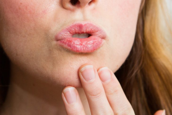 labios de mujer resecos 