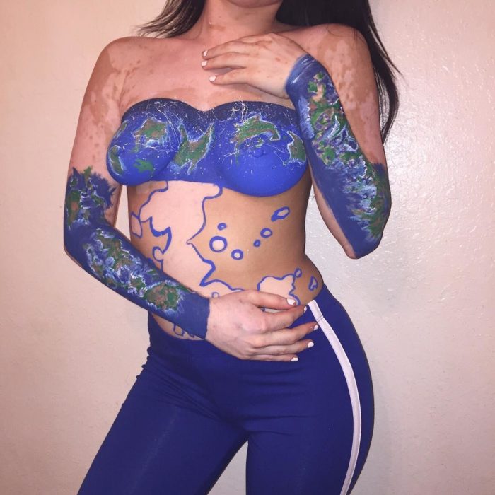 Chica que tiene vítiligo con su cuerpro pintado 