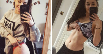 Publica imágenes de sus estrías y anima a las mujeres a no avergonzarse de sus ‘rayas de tigre’