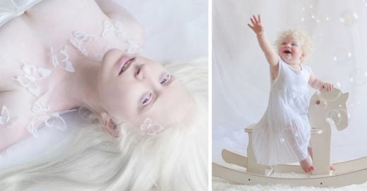 15 Fotografías que demuestran la fantástica belleza de las personas albinas
