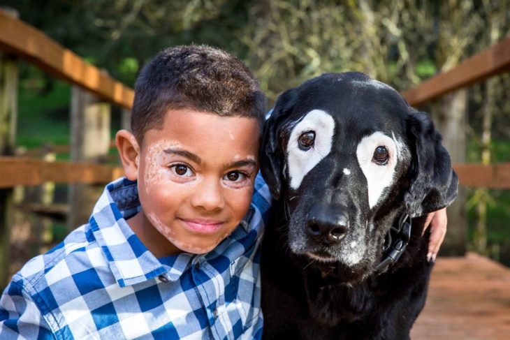 niño con perro negro y manchas blancas 