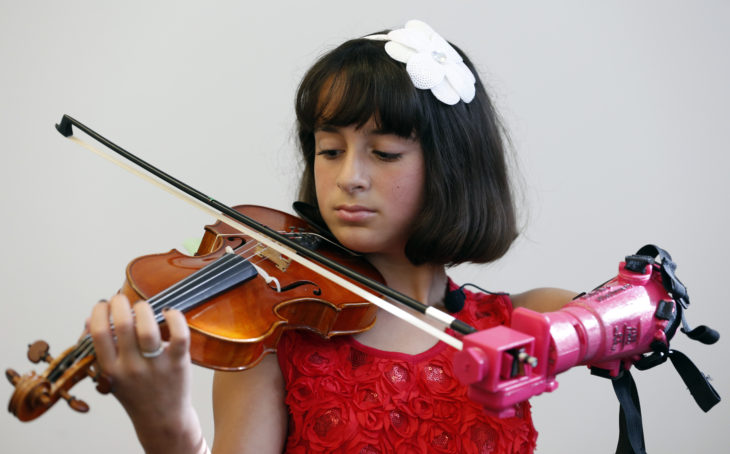 Prótesis brazo niña violín