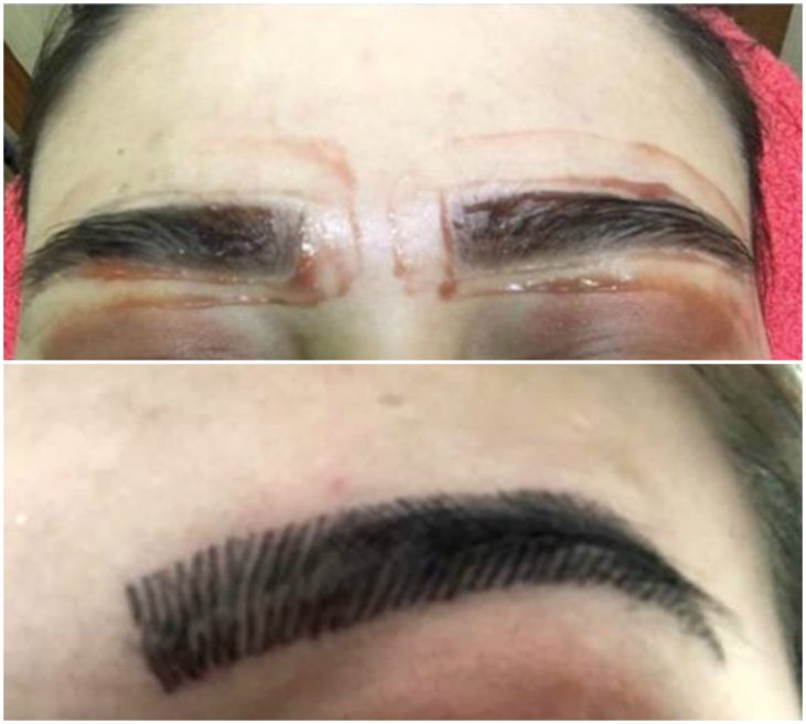 Microblading 