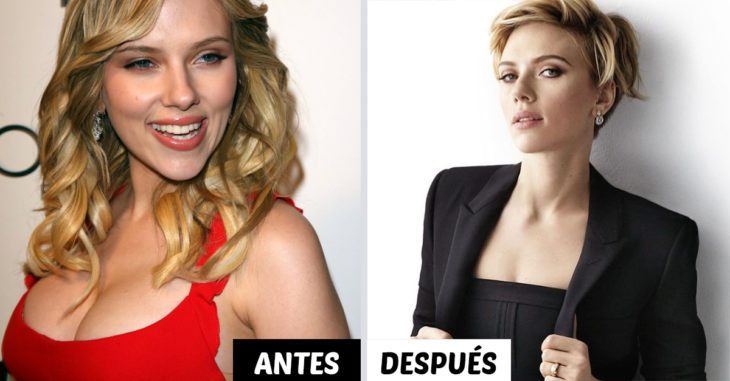 15 Celebridades que decidieron reducir sus senos