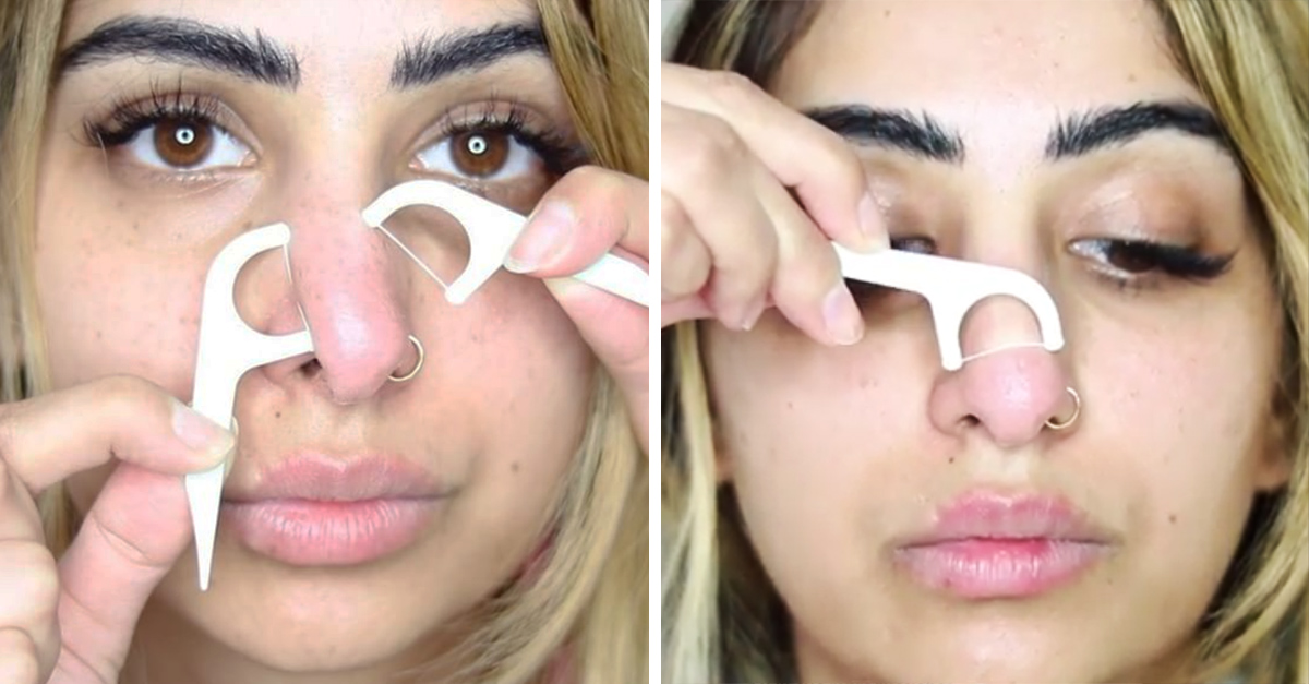 El hilo dental sí funciona para remover los puntos negros