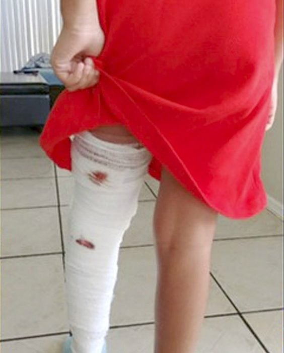 niña atacada por lagarto
