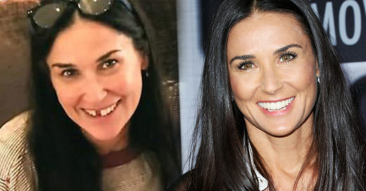 Demi Moore pierde los dientes a causa y esta es la razón