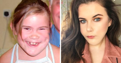 Nació con una deformación facial, y tras años de rehabilitación, ahora es una bloguera de belleza