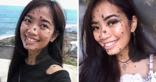 La llamaron 'monstruo' por los lunares que cubren su cuerpo; podría convertirse en Miss Universo Malasia 