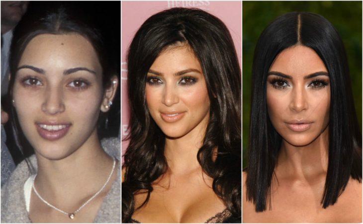 cirugía transformación kim kardashian