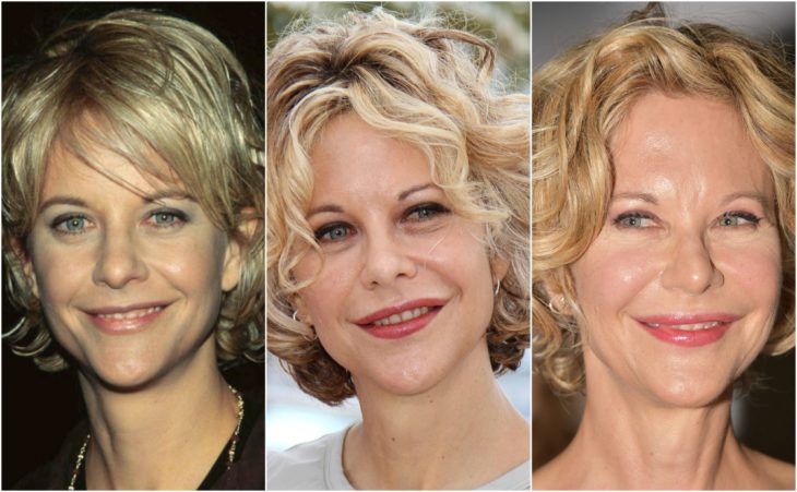 cirugia transformación meg ryan