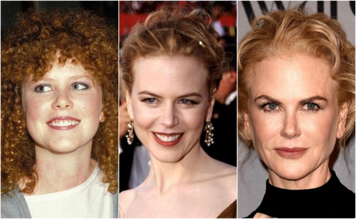 cirugia transformación nicole kidman