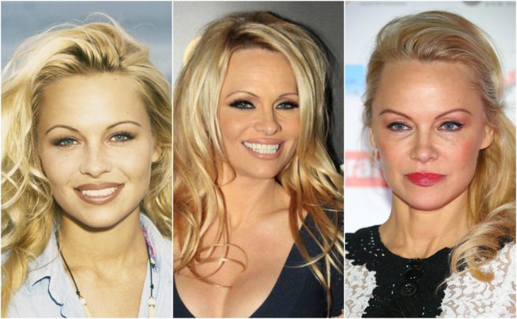 cirugia transformación pamela anderson