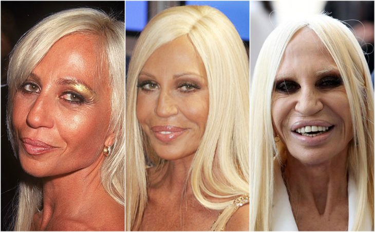 cirugía transformación donatella versace