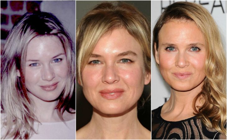 cirugía transformación renee zellweger