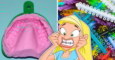 15 Situaciones de tortura que solo una chica que usó brackets entenderá