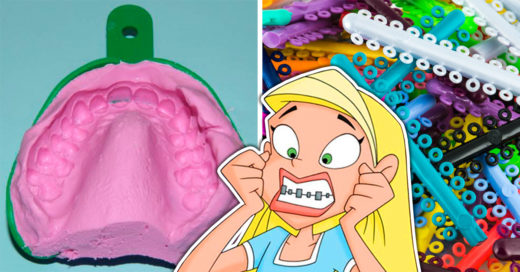 15 Situaciones que las personas con brackets han vivido