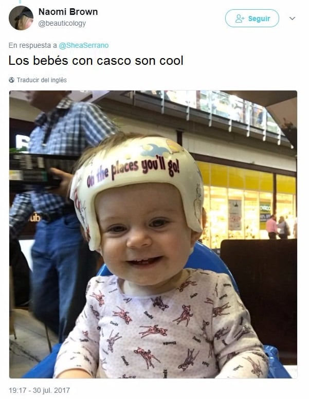 Un bebé debe llevar casco y toda la familia se solidariza con él