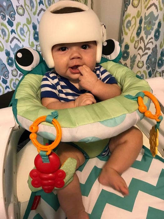 bebé con casco
