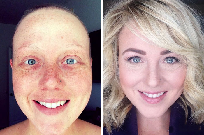 Antes y después de personas que vencieron el cáncer 