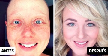 15 Imágenes antes y después de personas que lucharon contra el cáncer; su sonrisa lo dice todo