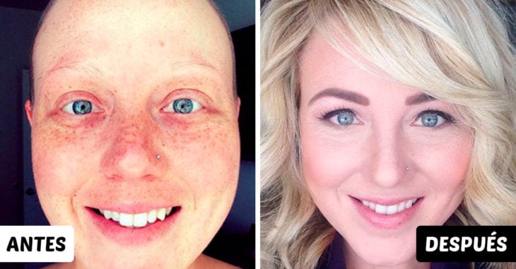 15 Fotografías del antes y después de personas que vencieron al cáncer
